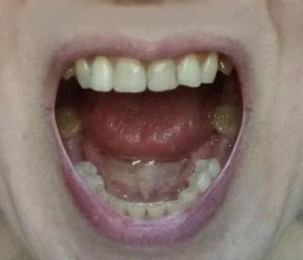 image-3